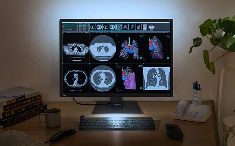 Monitors for every environment EIZO monitor